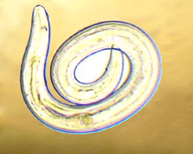 Protostrongylidae larvae from mollusks of Armenia (d)